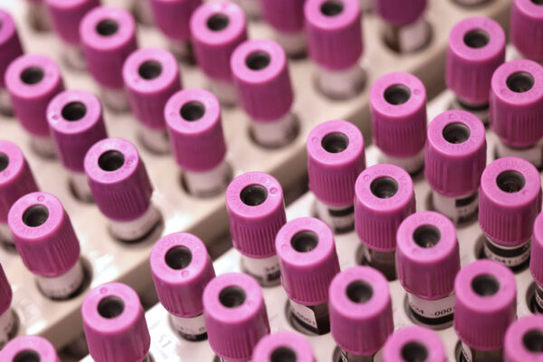 Samling av inzoomade lila provrör.